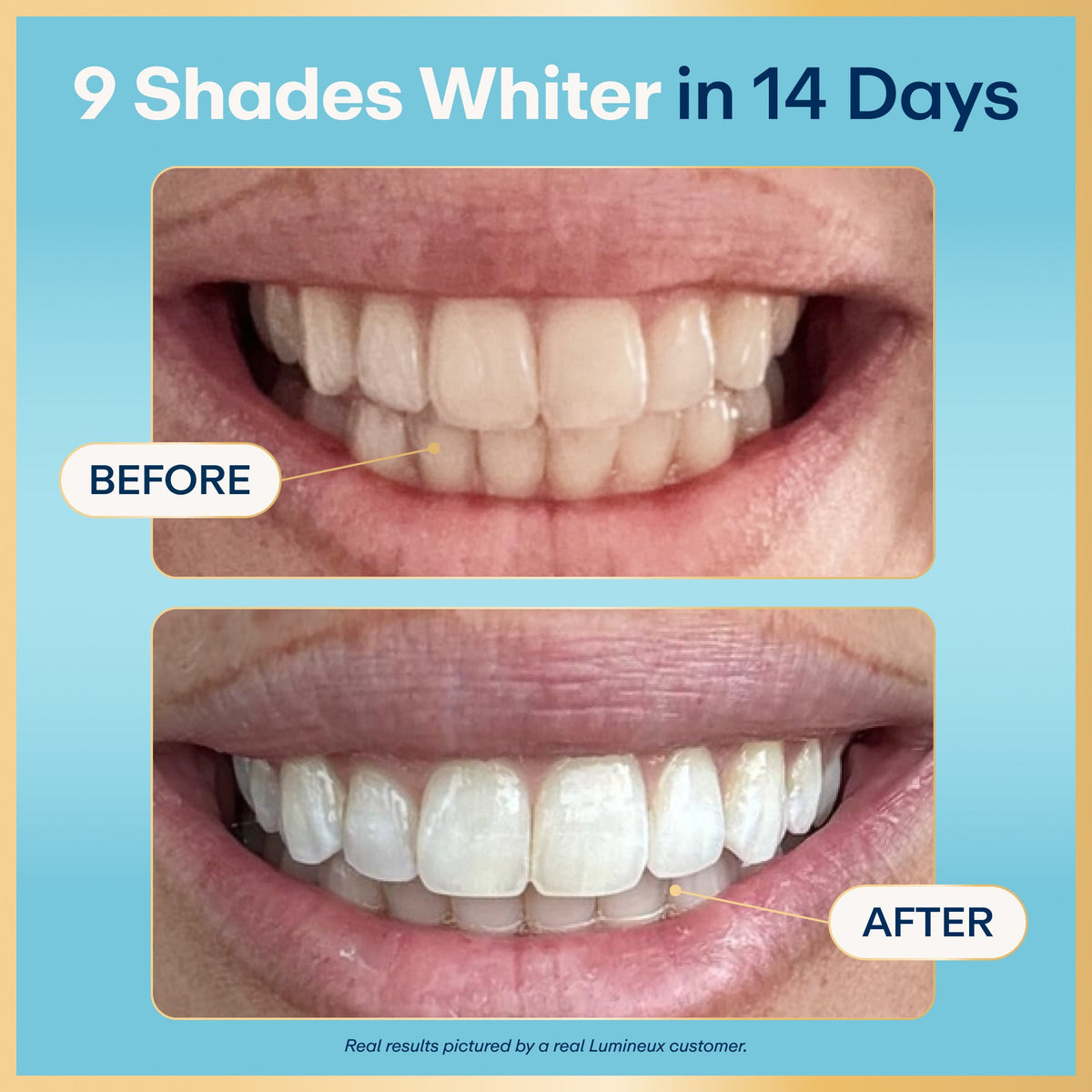 Lumineux® Super Pack Teeth Whitening Strips (21 Treatments)